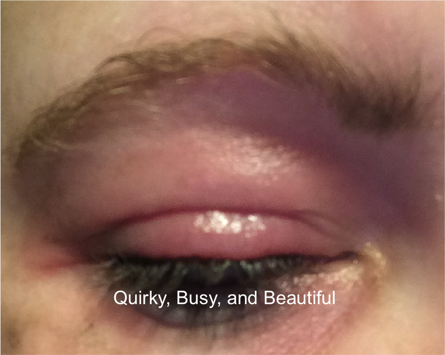 Quirky, Busy, and Beautiful: Makeup Allergies, and a Plea for Help! Makeup Allergic Reaction