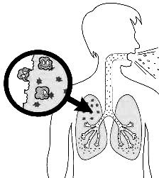 Bacterias de Tuberculosis TBC o TB para colorear pintar