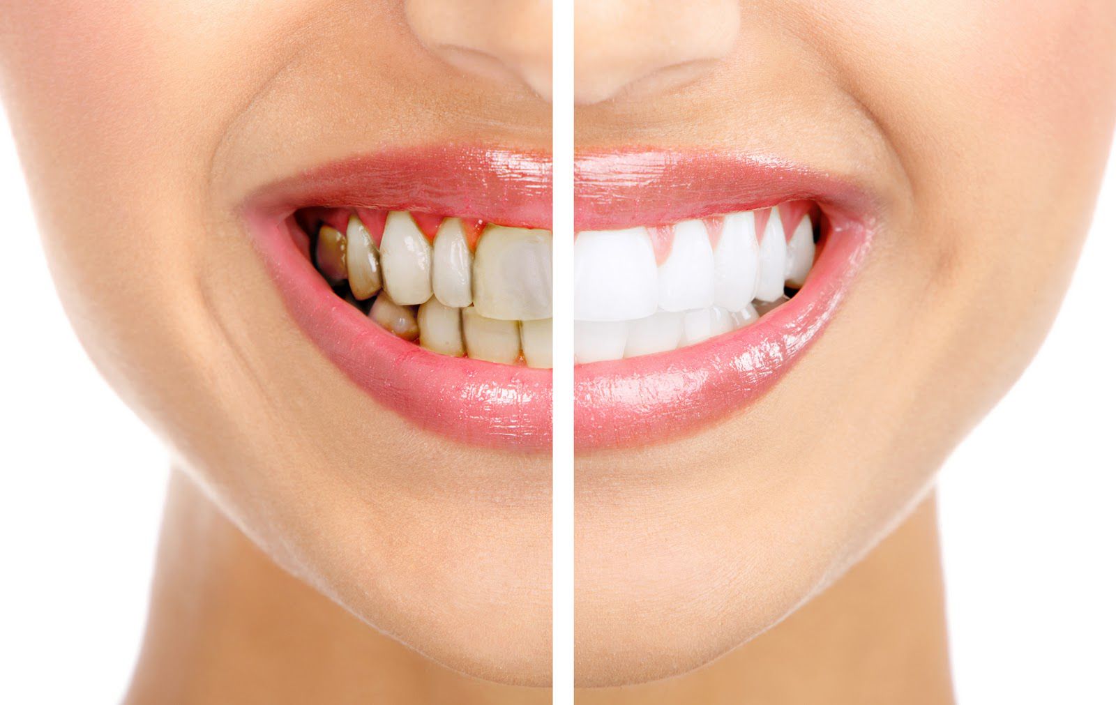 black-spots-on-the-teeth-near-gums-remove-with-home-remedies