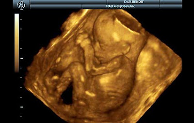 19 haftalık gebelik görüntüsü