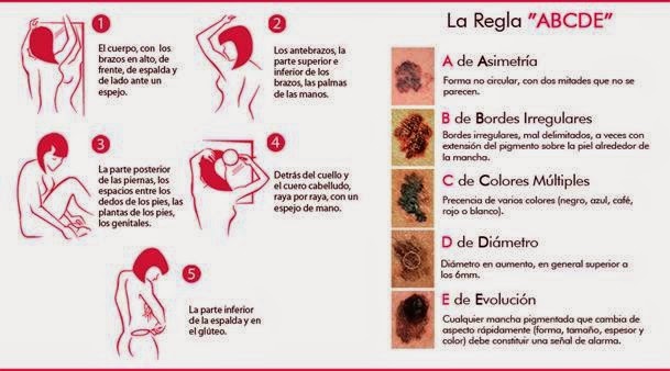 Regla de hipertensión abcd