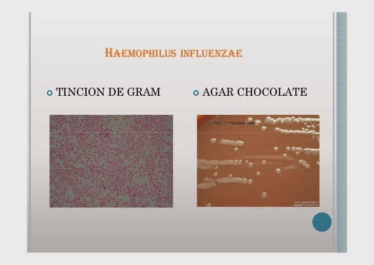 Fta Abs Anticorpos Igg Reagente O Que Significa - The Portuguese Blog