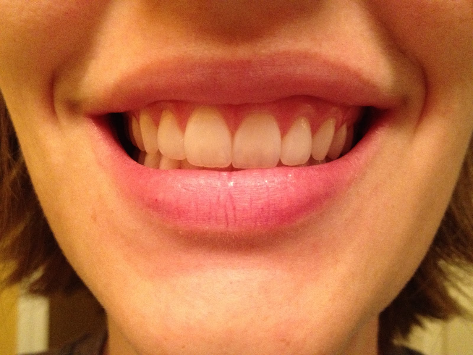 The DIY Guinea Pig Teeth Whitener