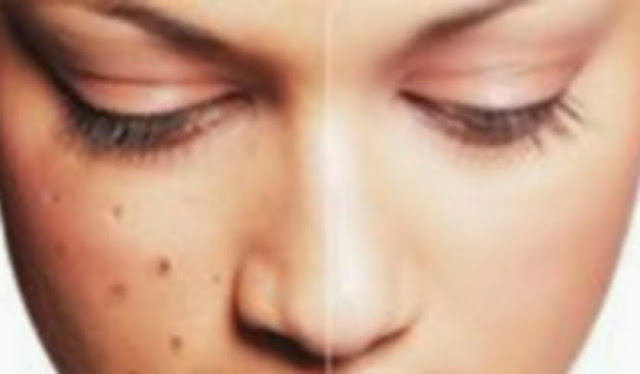 Wah, Ampas Teh Ternyata Sangat Bermanfaat Bagi Kecantikan Loh! Inilah 5 Manfaatnya Wah, Ampas Teh Ternyata Sangat Bermanfaat Bagi Kecantikan Loh! Inilah 5 Manfaatnya