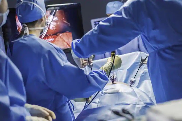 Soalan Soalan Lazim Untuk Pembedahan Laparoscopy