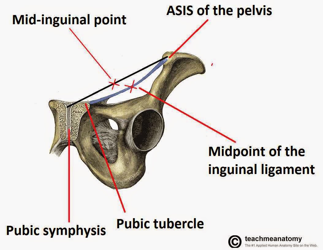 Inguinal Hernia in Egypt | Wemedical