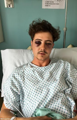 000 See the way this Tottenham fan was beaten by his own club's fans who thought he was a Chelsea fan