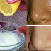 It Only Takes 2 Ingredient To Remove Pores On Your Face