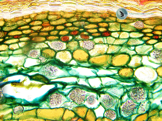 Microscope World image of Tilia under the microscope at 400x.