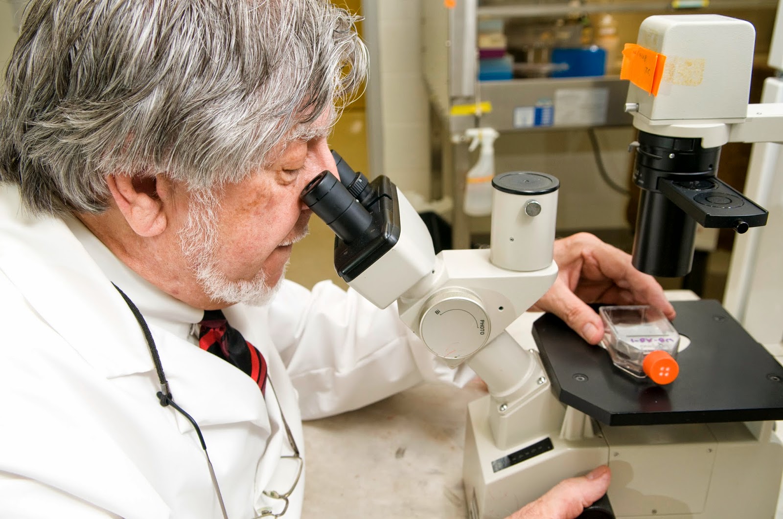 Why Tobacco Smoking is the Strongest Risk Factor for Pancreatic Cancer