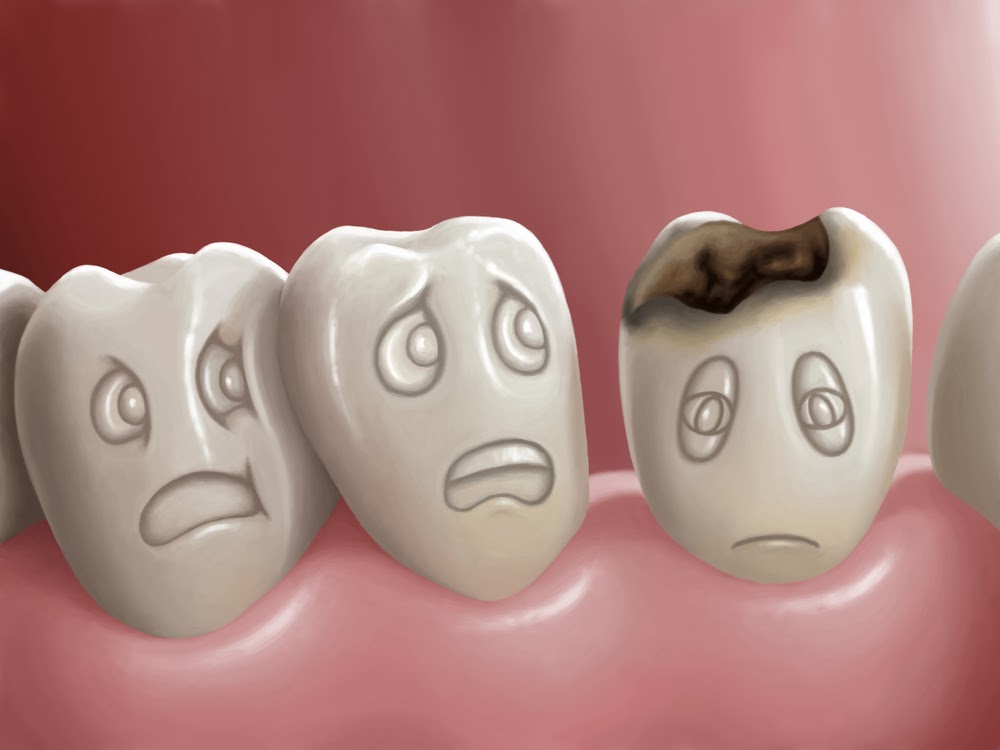 Daily Dentist What's that Word? Dental Jargon from A to Z F is for