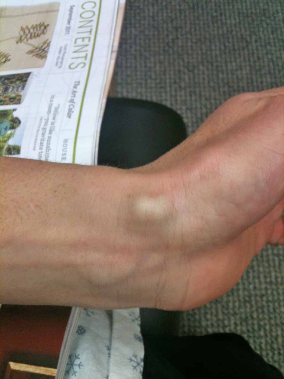 {Cleverly Crafty}: {W}rist Issues are Done