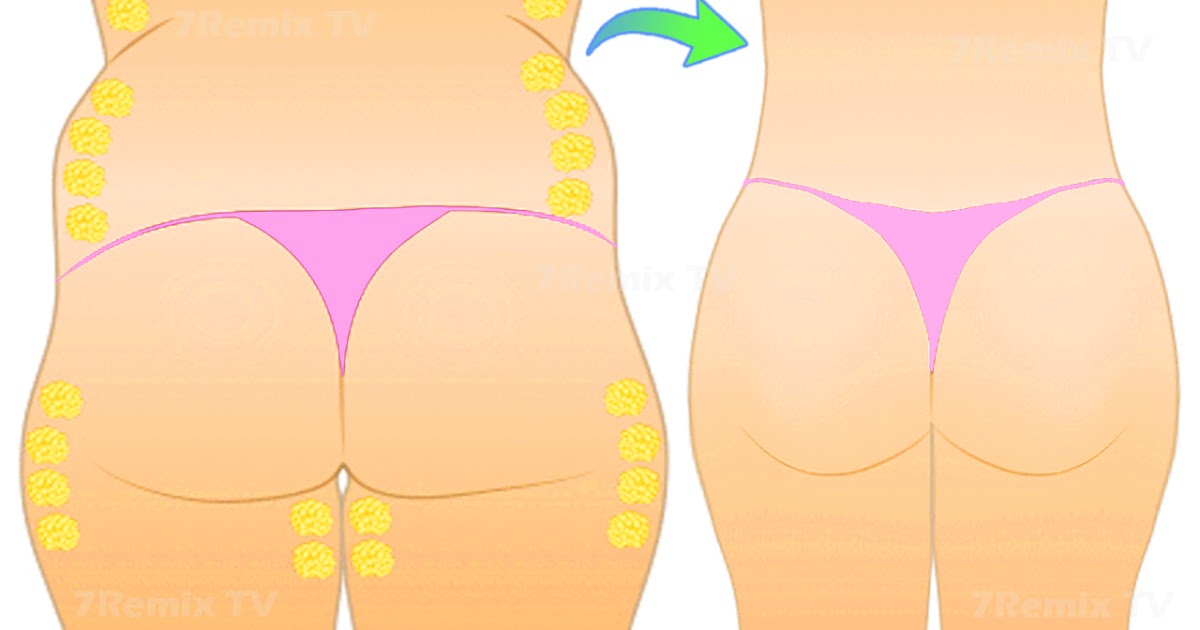 How To Reduce Buttock Fat With 5 Moves For Your Butt Hips And Thighs