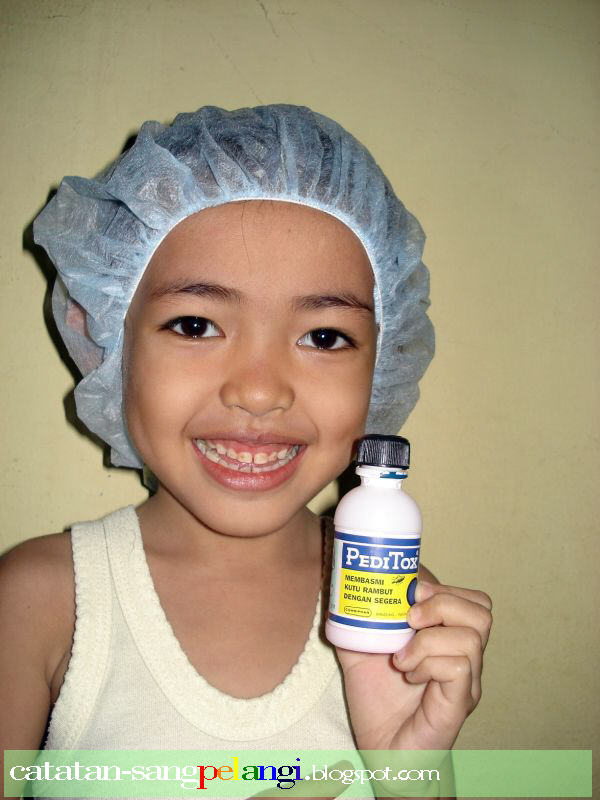 Waduhhhh. Kepalaku Kok Gatel Melulu Sih | Catatan Sang Pelangi