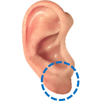 Ear lobe (cuping telinga) Ear lobe (cuping telinga)