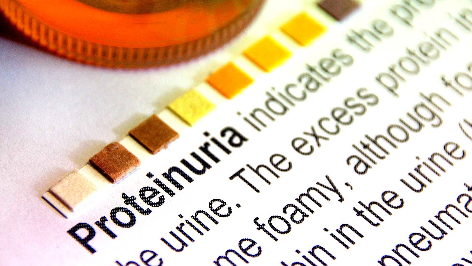 Amount Of Protein In Urine Protein Choices