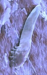 Demodex folliculorum Jenis-Jenis Arthropoda Patogen (Sikilus Hidup, Gejala Klinis, Pencegahan & Pengobatan)