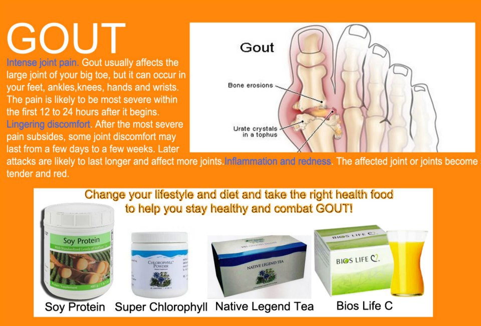 Unicity Health Supplements & Home based Networking Business Gout and