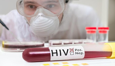 Tanda-Tanda Awal Infeksi HIV Yang Perlu Diketahui