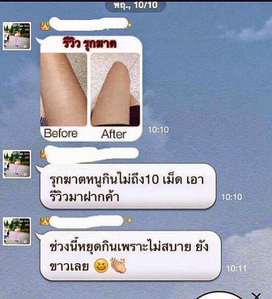 My Image 101