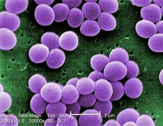 Pengelompokan bakteri berdasarkan bentuk Stafilokokus contohnya yaitu Staphylococcus aureus
