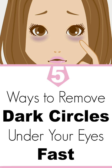 5 Ways to Remove Dark Circles Under Your Eyes Fast