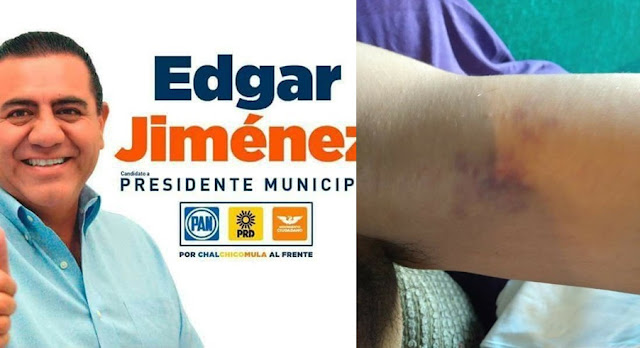Candidato por el Frente en Ciudad Serdán golpea a campesino en pleno mitin