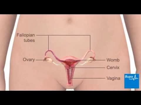 Can I Travel Weeks After A Hysterectomy Can I Travel Weeks After A Hysterectomy