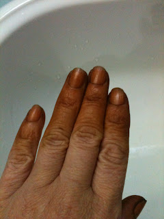 Prevenção e tratamento com permanganato de potássio