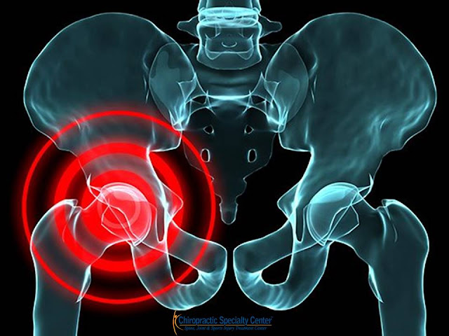Hip And Groin Pain In Athletes