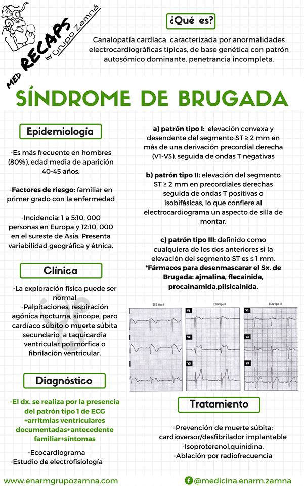 sindrome de brugada sindrome de brugada