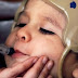 DEA Ridiculed: American Epilepsy Society Announce Cannabis Extract Obliterates Epileptic Seizures in Children