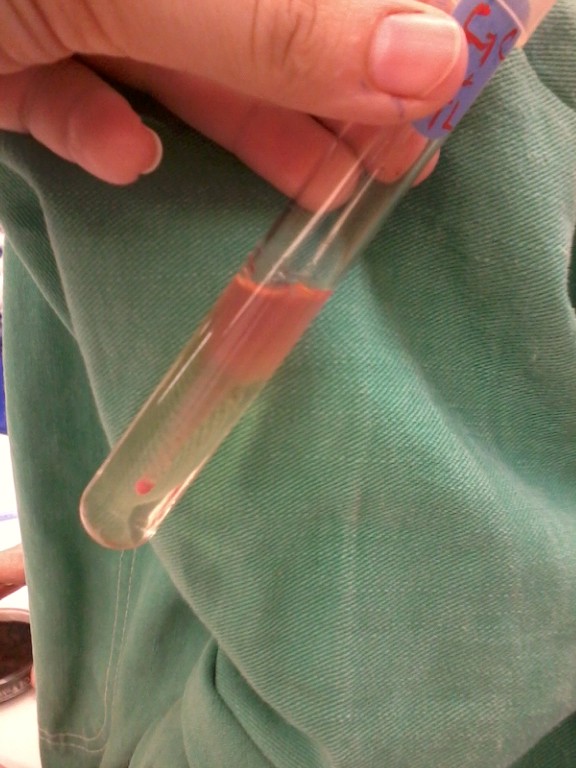 Gram negative bacteria in gelatin hydrolysis test Derdfw