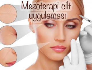 Dr Zeynep Kirker Medikal Estetik Poliklinigi Gozalti Goz Alti Mezoterapisi Goz Alti Morluklari Ve Goz Kapaklari Tedavisi