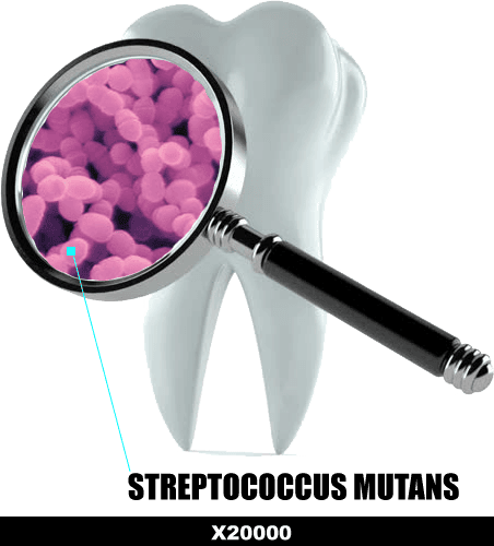 The Ugly Truth About Cavities - DEALSPOINT360