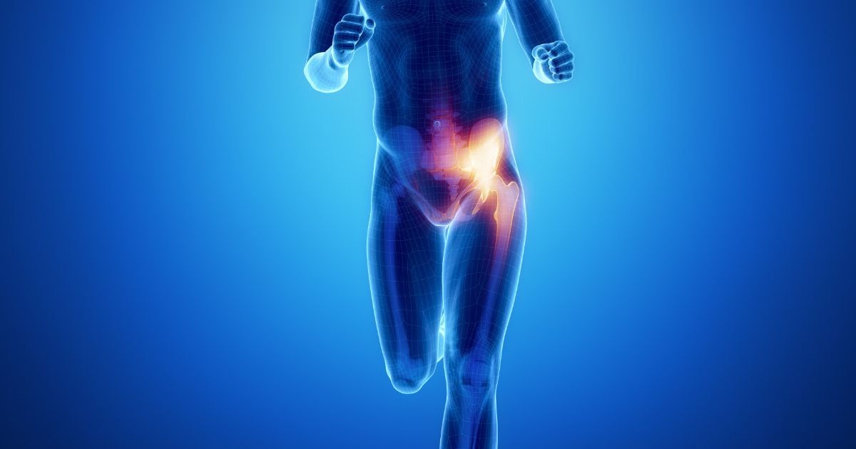 What Is A Sports Hernia? Know Important Things Related To It.