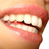 How to whiten teeth for a beautiful smile