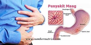 Image KUMPULAN OBAT MAAG DAN ASAM LAMBUNG PALING MUJARAB