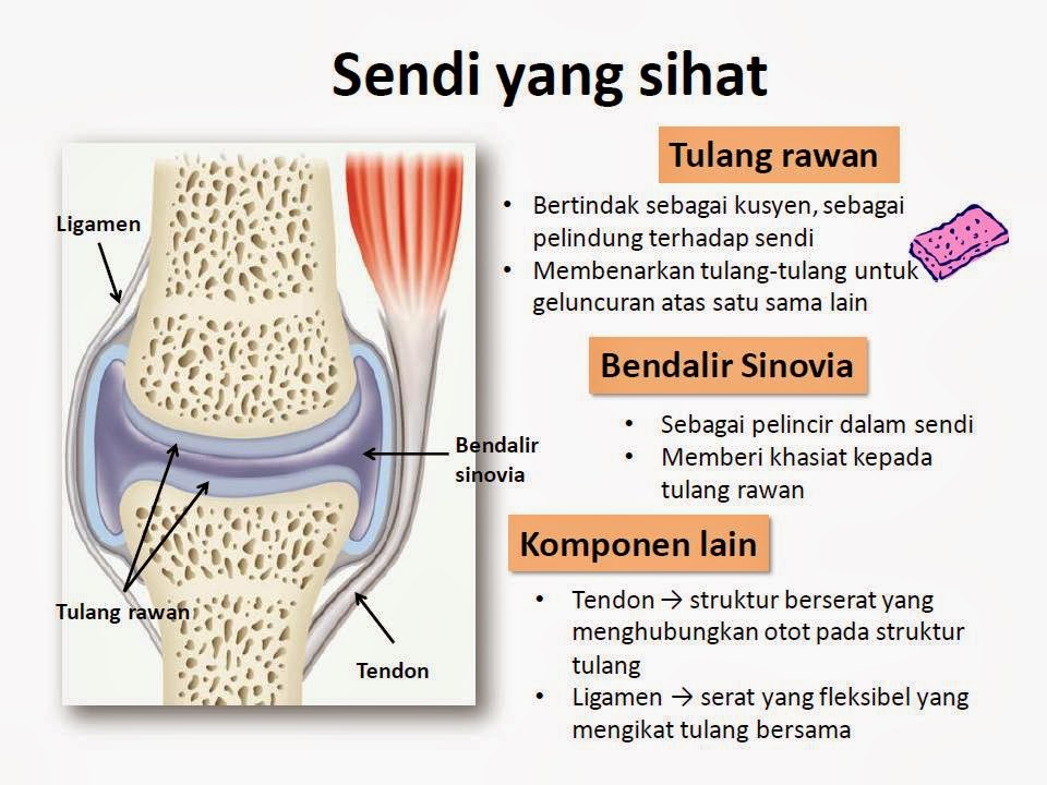 Apa itu arthritis