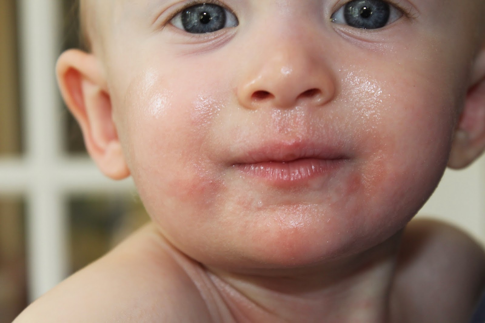 keeping-up-with-the-kiddos-food-allergy-frenzy