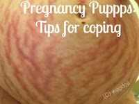 http://www.wagdoll.co.uk/2016/07/pregnancy-puppps-rash-essential-tips.html