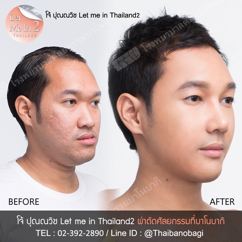 อันดับหนึ่ง 93+ ภาพพื้นหลัง ทรงสี่หน้าบิดเบี้ยว สวยมาก อันดับหนึ่ง 93+ ภาพพื้นหลัง ทรงสี่หน้าบิดเบี้ยว สวยมาก