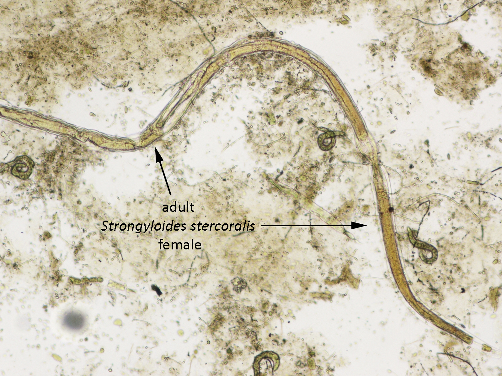 Creepy Dreadful Wonderful Parasites: Answer to Case 469