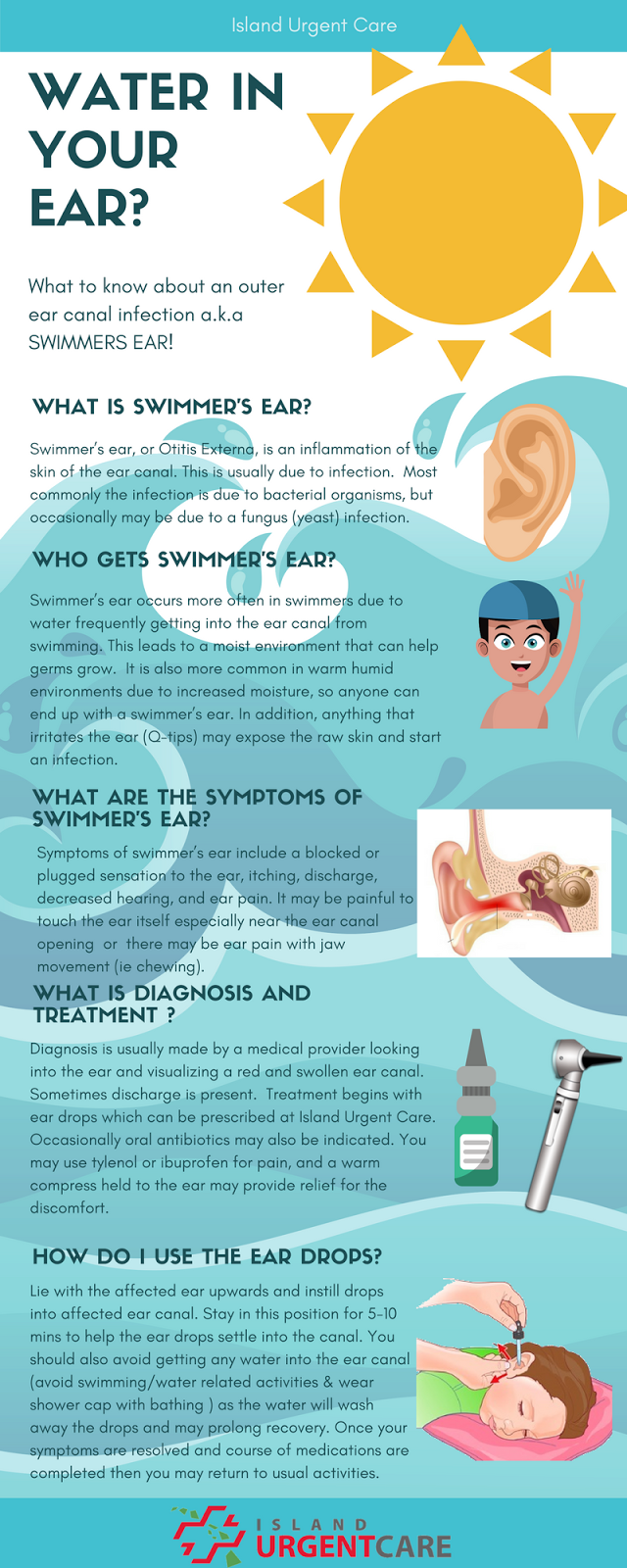 Island Urgent Care Blog Physician Friday Water in Your Ear? Swimmers Ear