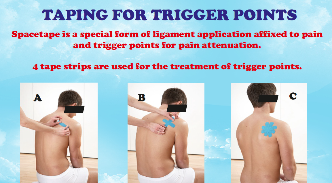 DrMitrPhysio Taping for Trigger Points