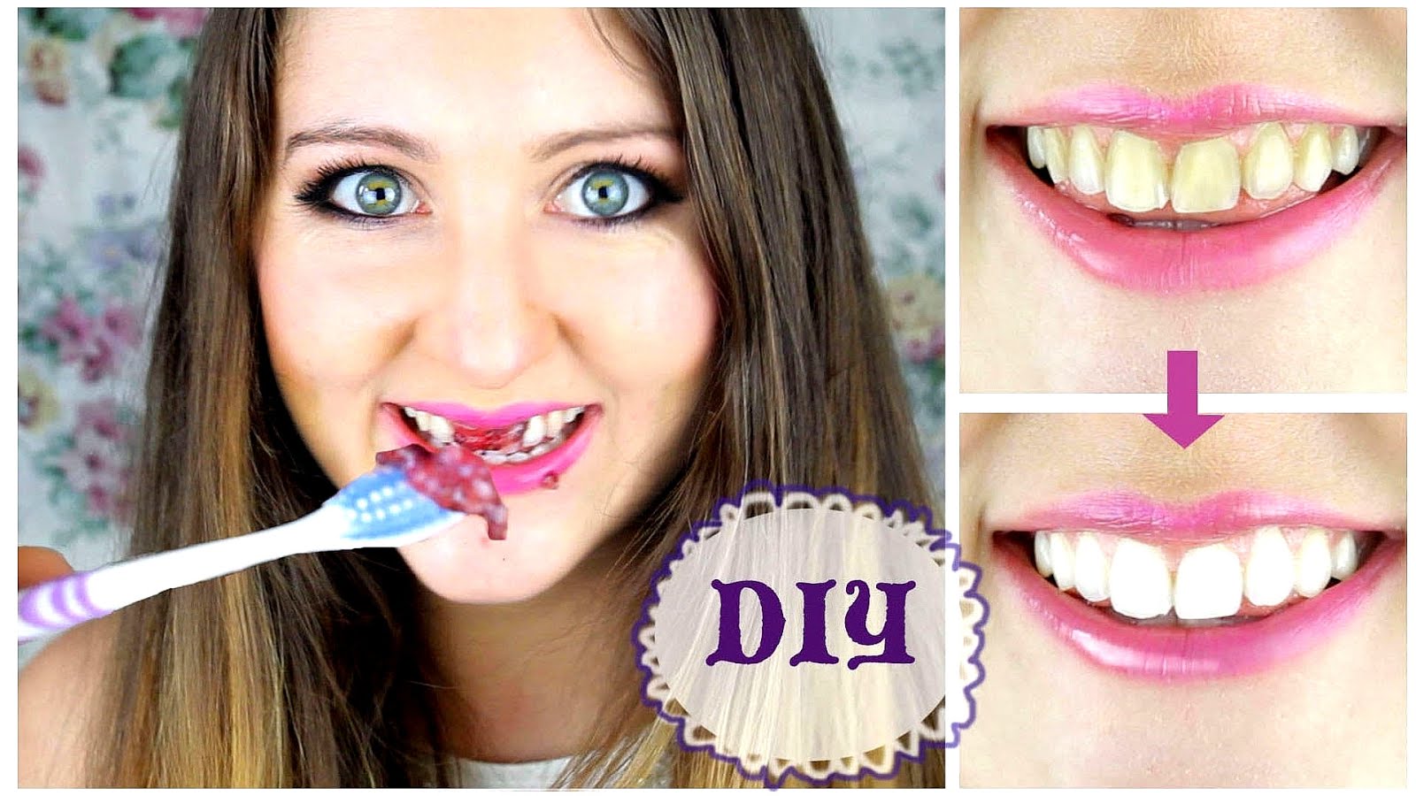 How To Make Yellow Teeth White At Home Yellow Choices