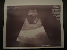 Baby JJ's 8 Week Ultrasound