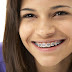 Khách hàng nghĩ gì nếu thực hiện niềng răng không cần nhổ răng?