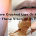 If You Have Cracked Lips Or Hair Loss, You Need These Vitamins In Your Body!