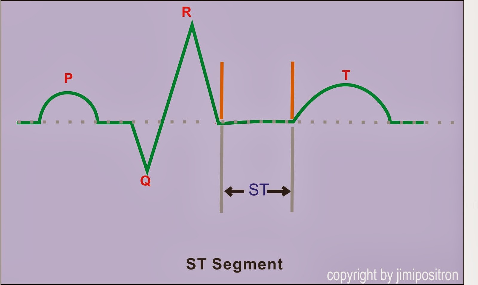 Interval Pada EKG